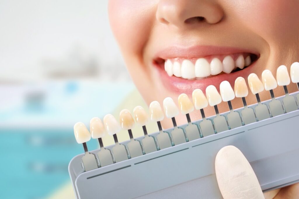 dental exam, dentist, fairfax, teeth whitening